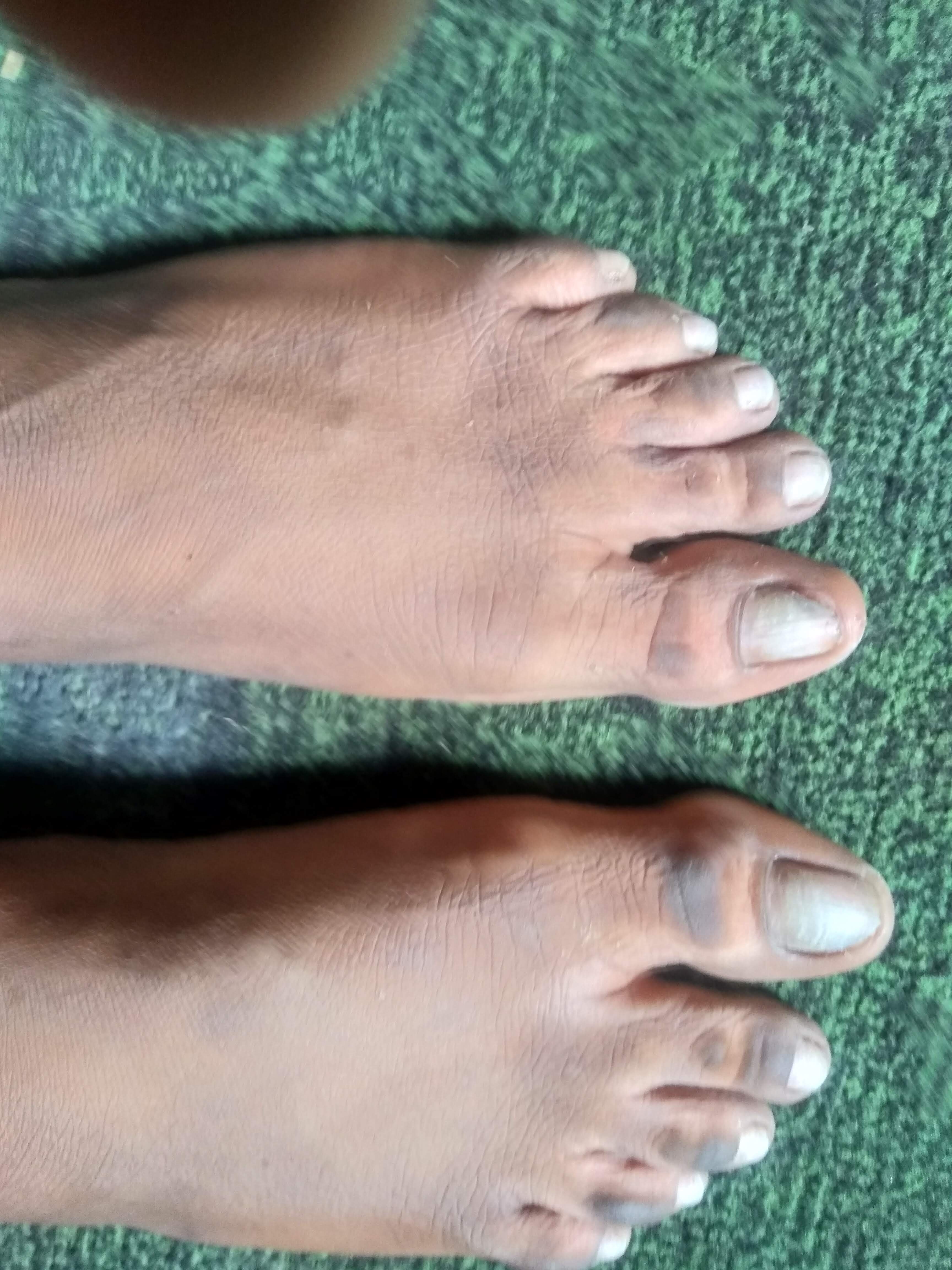 After — Skin Transformation